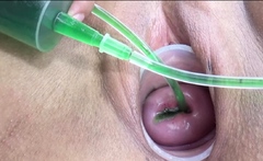 Cervix And Pee Hole Inflation With Injections For Japan Lesb